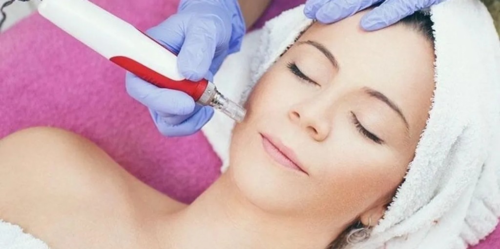 Dermapen (Microagulhamento)